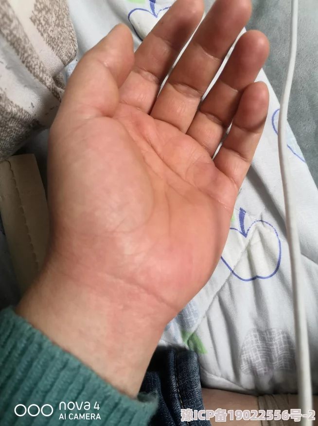 固定手脚的痒女生的脚心，医生建议多种缓解方法以改善症状并提升生活质量